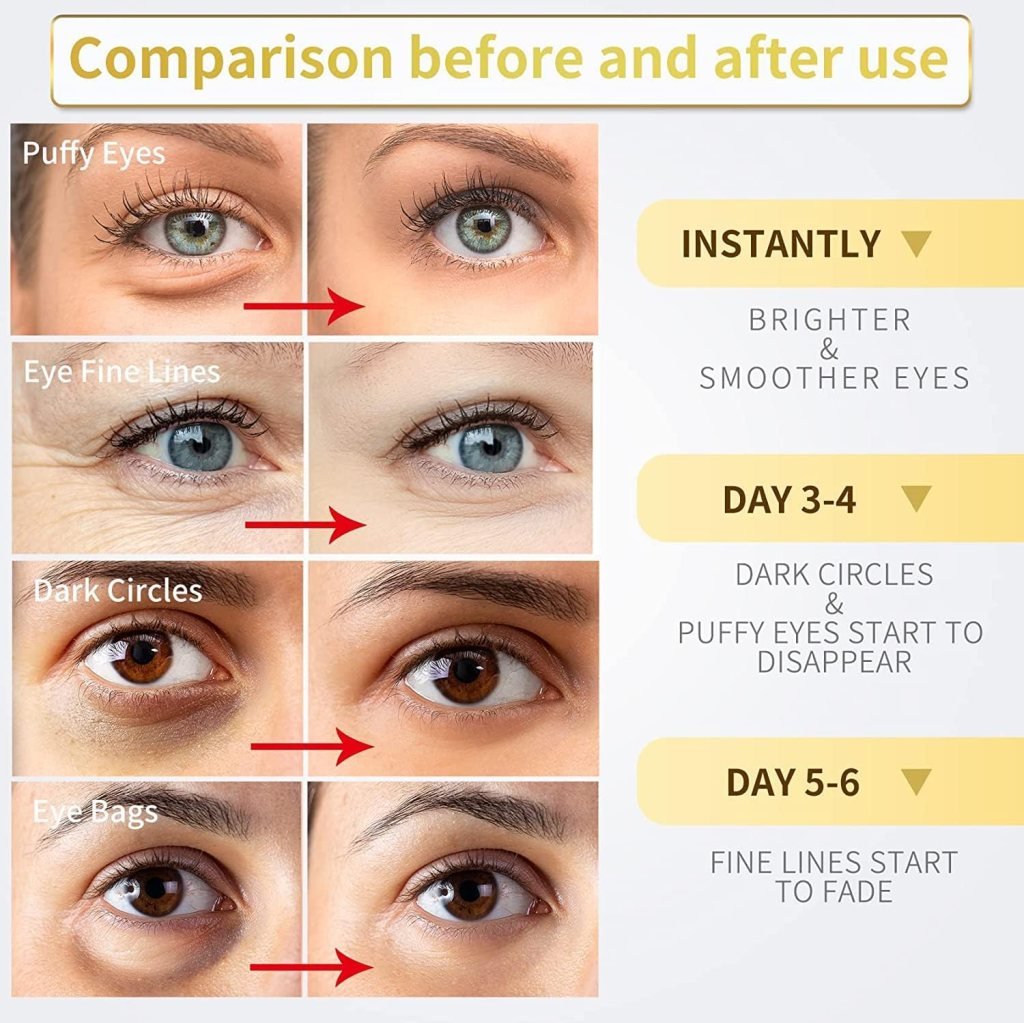 24K Gold Under Eye Patches