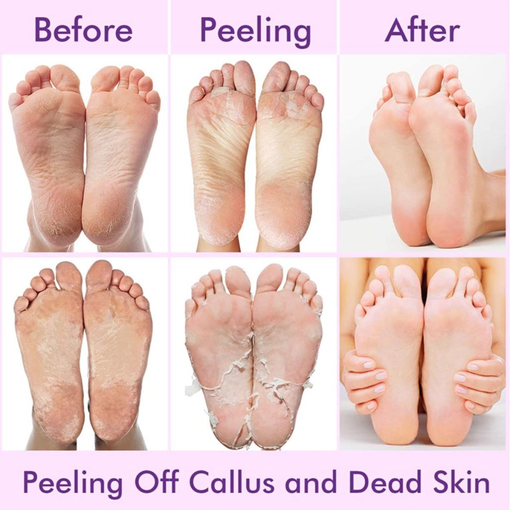Foot Peeling Mask Dead Skin remover